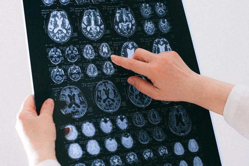 Ile zarabia radiolog? Poznaj średnie zarobki w tej specjalizacji!