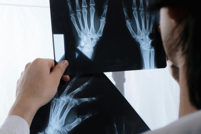 Jakie są średnie zarobki ortopedy w Polsce? Sprawdź, ile naprawdę można zarobić